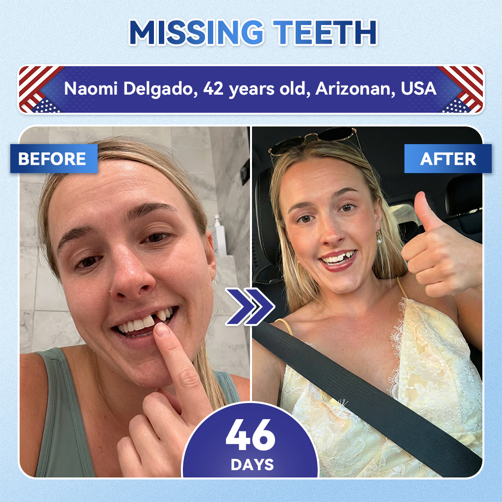 Your Smile~ Borvexis® 🦷 Tideglusib Fast‑Dissolving Tooth & Gum Repair Oral Strips ✨ (𝟓-𝐢𝐧-𝟏 💎 𝐑𝐞𝐛𝐮𝐢𝐥𝐝 𝐄𝐧𝐚𝐦𝐞𝐥 & 𝐃𝐞𝐧𝐭𝐢𝐧 • 𝐒𝐭𝐫𝐞𝐧𝐠𝐭𝐡𝐞𝐧 𝐆𝐮𝐦𝐬 • 𝐄𝐫𝐚𝐝𝐢𝐜𝐚𝐭𝐞 𝐓𝐚𝐫𝐭𝐚𝐫 & 𝐎𝐝𝐨𝐫 • 𝐖𝐡𝐢𝐭𝐞𝐧𝐢𝐧𝐠 • 𝐒𝐭𝐨𝐩 𝐓𝐨𝐨𝐭𝐡 𝐒𝐞𝐧𝐬𝐢𝐭𝐢𝐯𝐢𝐭𝐲)