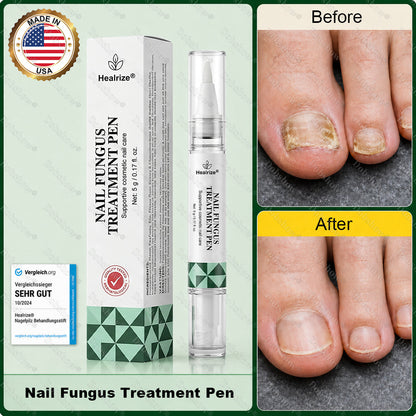 𝗛𝗲𝗮𝗹𝗿𝗶𝘇𝗲® 𝗡𝗮𝗶𝗹 𝗙𝘂𝗻𝗴𝘂𝘀 𝗧𝗿𝗲𝗮𝘁𝗺𝗲𝗻𝘁 𝗣𝗲𝗻