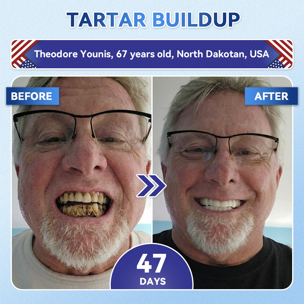 Your Smile~ Borvexis® 🦷 Tideglusib Fast‑Dissolving Tooth & Gum Repair Oral Strips ✨ (𝟓-𝐢𝐧-𝟏 💎 𝐑𝐞𝐛𝐮𝐢𝐥𝐝 𝐄𝐧𝐚𝐦𝐞𝐥 & 𝐃𝐞𝐧𝐭𝐢𝐧 • 𝐒𝐭𝐫𝐞𝐧𝐠𝐭𝐡𝐞𝐧 𝐆𝐮𝐦𝐬 • 𝐄𝐫𝐚𝐝𝐢𝐜𝐚𝐭𝐞 𝐓𝐚𝐫𝐭𝐚𝐫 & 𝐎𝐝𝐨𝐫 • 𝐖𝐡𝐢𝐭𝐞𝐧𝐢𝐧𝐠 • 𝐒𝐭𝐨𝐩 𝐓𝐨𝐨𝐭𝐡 𝐒𝐞𝐧𝐬𝐢𝐭𝐢𝐯𝐢𝐭𝐲)