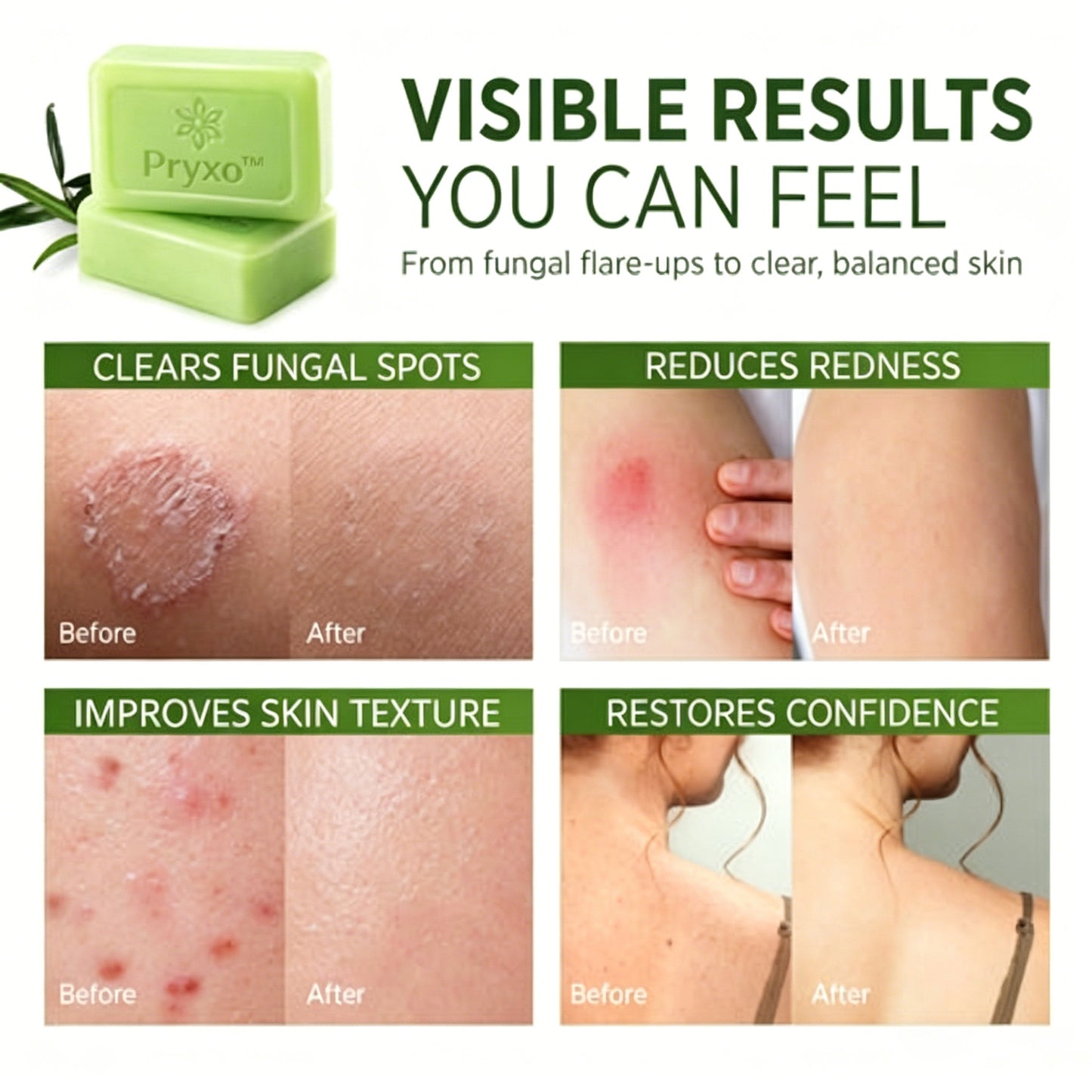 Pryxo™The Japanese AntiFungal Relief Soap Bar(The second item is 60% off!)