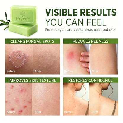 Pryxo™The Japanese AntiFungal Relief Soap Bar(The second item is 60% off!)