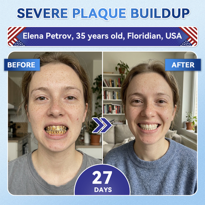 Your Smile~ Borvexis® 🦷 Tideglusib Fast‑Dissolving Tooth & Gum Repair Oral Strips ✨ (𝟓-𝐢𝐧-𝟏 💎 𝐑𝐞𝐛𝐮𝐢𝐥𝐝 𝐄𝐧𝐚𝐦𝐞𝐥 & 𝐃𝐞𝐧𝐭𝐢𝐧 • 𝐒𝐭𝐫𝐞𝐧𝐠𝐭𝐡𝐞𝐧 𝐆𝐮𝐦𝐬 • 𝐄𝐫𝐚𝐝𝐢𝐜𝐚𝐭𝐞 𝐓𝐚𝐫𝐭𝐚𝐫 & 𝐎𝐝𝐨𝐫 • 𝐖𝐡𝐢𝐭𝐞𝐧𝐢𝐧𝐠 • 𝐒𝐭𝐨𝐩 𝐓𝐨𝐨𝐭𝐡 𝐒𝐞𝐧𝐬𝐢𝐭𝐢𝐯𝐢𝐭𝐲)