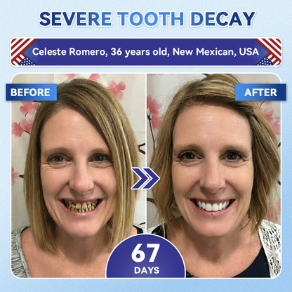 Your Smile~ Borvexis® 🦷 Tideglusib Fast‑Dissolving Tooth & Gum Repair Oral Strips ✨ (𝟓-𝐢𝐧-𝟏 💎 𝐑𝐞𝐛𝐮𝐢𝐥𝐝 𝐄𝐧𝐚𝐦𝐞𝐥 & 𝐃𝐞𝐧𝐭𝐢𝐧 • 𝐒𝐭𝐫𝐞𝐧𝐠𝐭𝐡𝐞𝐧 𝐆𝐮𝐦𝐬 • 𝐄𝐫𝐚𝐝𝐢𝐜𝐚𝐭𝐞 𝐓𝐚𝐫𝐭𝐚𝐫 & 𝐎𝐝𝐨𝐫 • 𝐖𝐡𝐢𝐭𝐞𝐧𝐢𝐧𝐠 • 𝐒𝐭𝐨𝐩 𝐓𝐨𝐨𝐭𝐡 𝐒𝐞𝐧𝐬𝐢𝐭𝐢𝐯𝐢𝐭𝐲)
