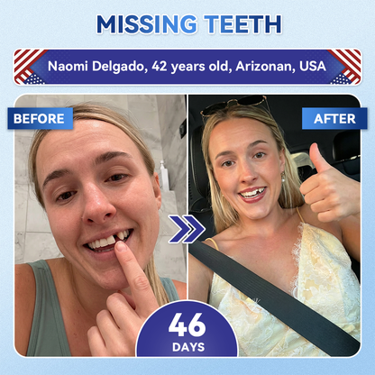 Your Smile~ Borvexis® 🦷 Tideglusib Fast‑Dissolving Tooth & Gum Repair Oral Strips ✨ (𝟓-𝐢𝐧-𝟏 💎 𝐑𝐞𝐛𝐮𝐢𝐥𝐝 𝐄𝐧𝐚𝐦𝐞𝐥 & 𝐃𝐞𝐧𝐭𝐢𝐧 • 𝐒𝐭𝐫𝐞𝐧𝐠𝐭𝐡𝐞𝐧 𝐆𝐮𝐦𝐬 • 𝐄𝐫𝐚𝐝𝐢𝐜𝐚𝐭𝐞 𝐓𝐚𝐫𝐭𝐚𝐫 & 𝐎𝐝𝐨𝐫 • 𝐖𝐡𝐢𝐭𝐞𝐧𝐢𝐧𝐠 • 𝐒𝐭𝐨𝐩 𝐓𝐨𝐨𝐭𝐡 𝐒𝐞𝐧𝐬𝐢𝐭𝐢𝐯𝐢𝐭𝐲)