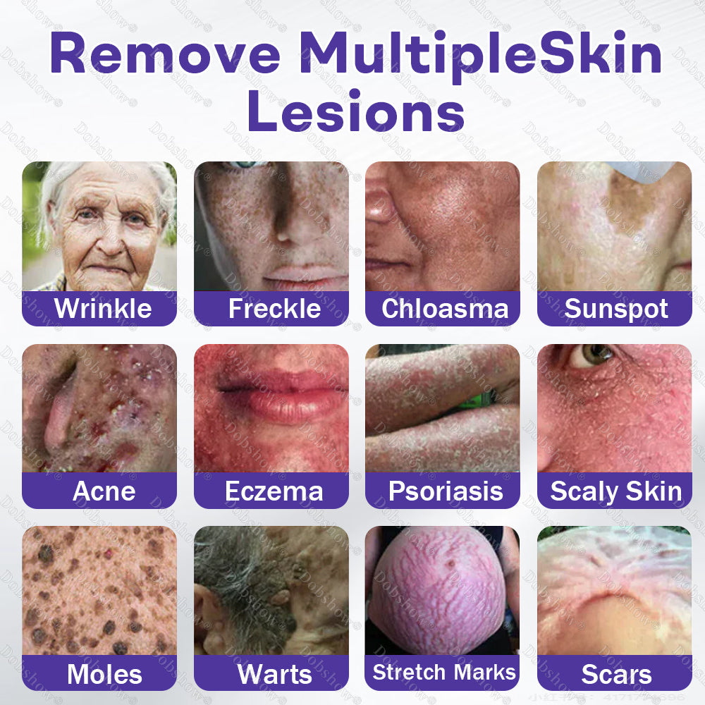 ✨Dobshow® Wart and mole removal microneedle patch