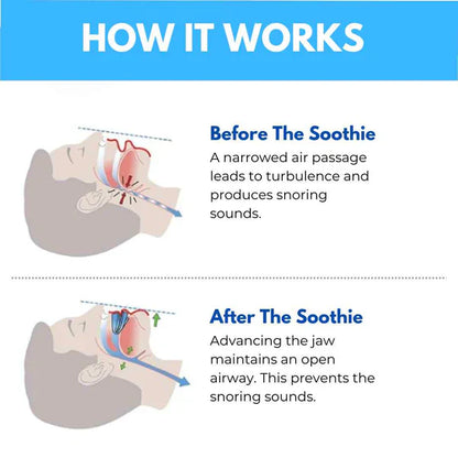 Snore Free+ Anti-Snoring Mouthpiece Universal Size