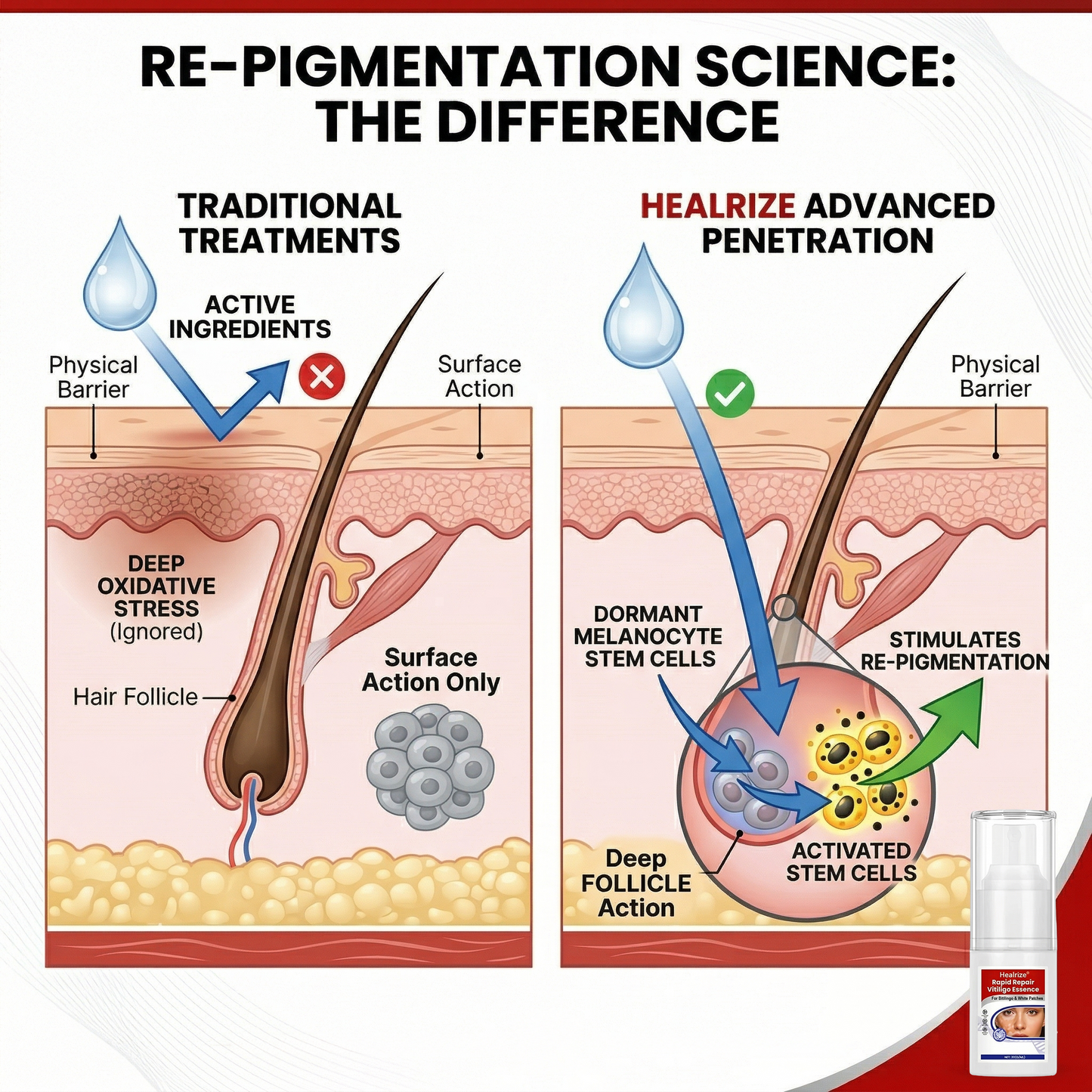 🔥Healrize® Rapid Repair Vitiligo Essence — Visible Results in Weeks, 100% Natural & Steroid-Free