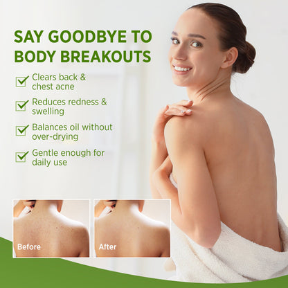 Pryxo™The Japanese AntiFungal Relief Soap Bar(The second item is 60% off!)