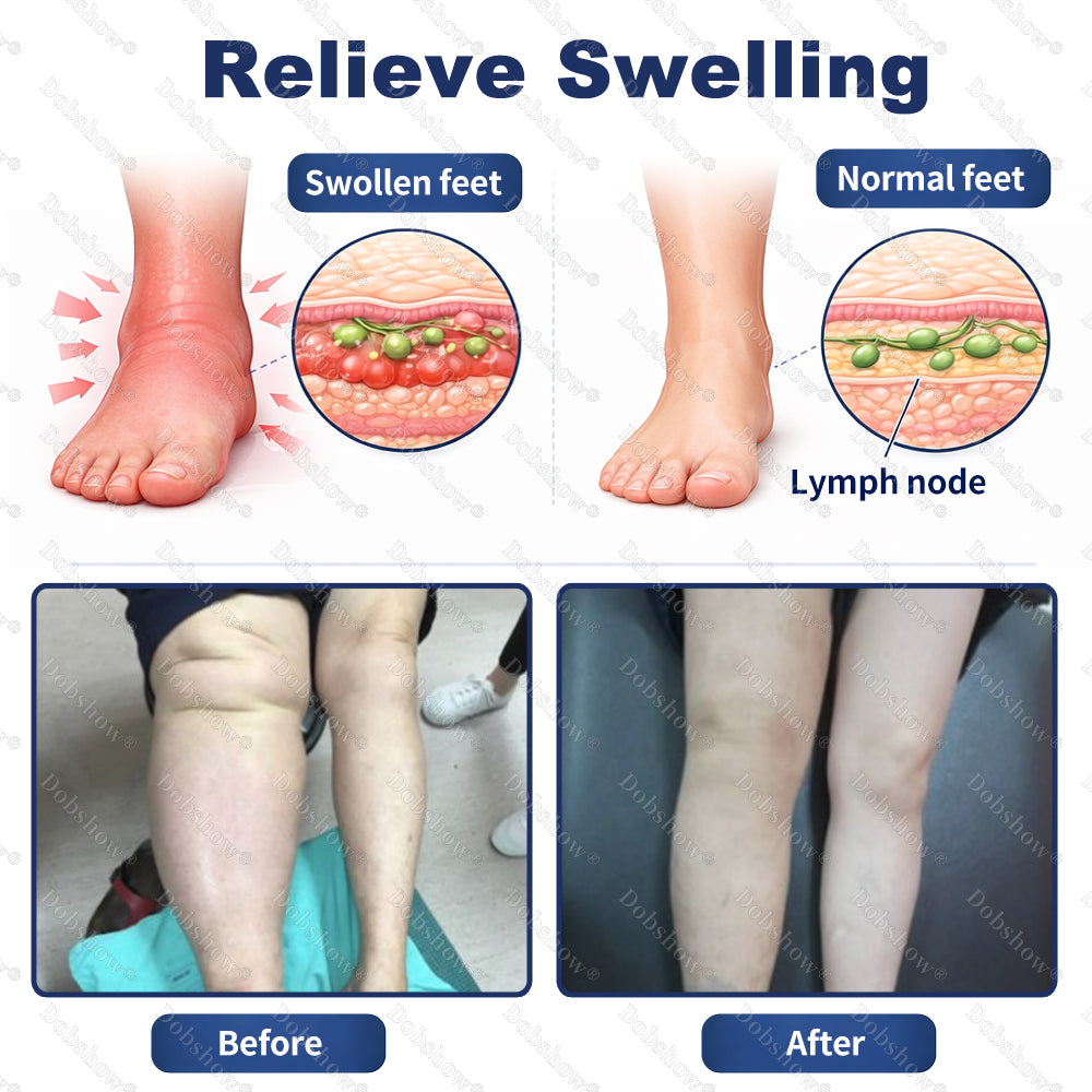 𝗛𝗲𝗮𝗹𝗿𝗶𝘇𝗲® 𝗟𝘆𝗺𝗽𝗵𝗮𝗣𝘂𝗿𝗲 𝗗𝗲𝗲𝗽 𝗗𝗿𝗮𝗶𝗻𝗮𝗴𝗲 𝗧𝗵𝗲𝗿𝗮𝗽𝘆