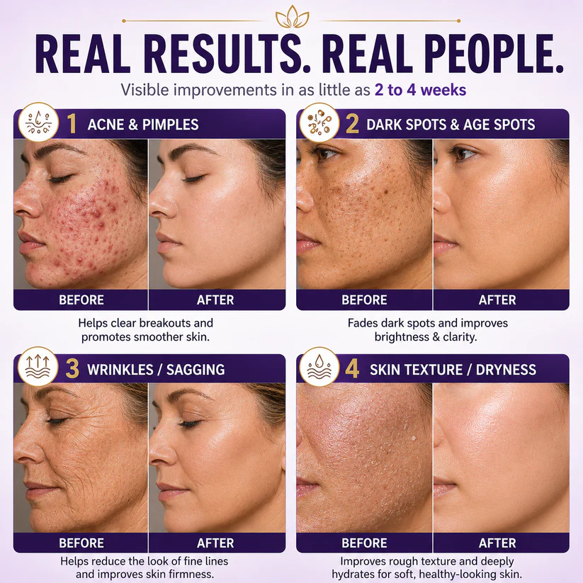 Limited-time offer: 70% off ⬇️Elivessa™ Biotin 10-in-1 Skin Restoration Cream