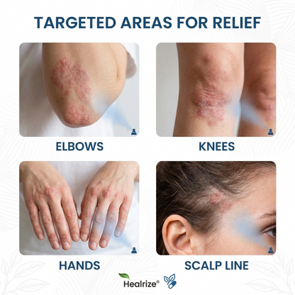 🌿Healrize® Magnesium Botanical Spray – Advanced Skin Recovery for Psoriasis & Eczema | Rapid Soothing, Steroid-Free