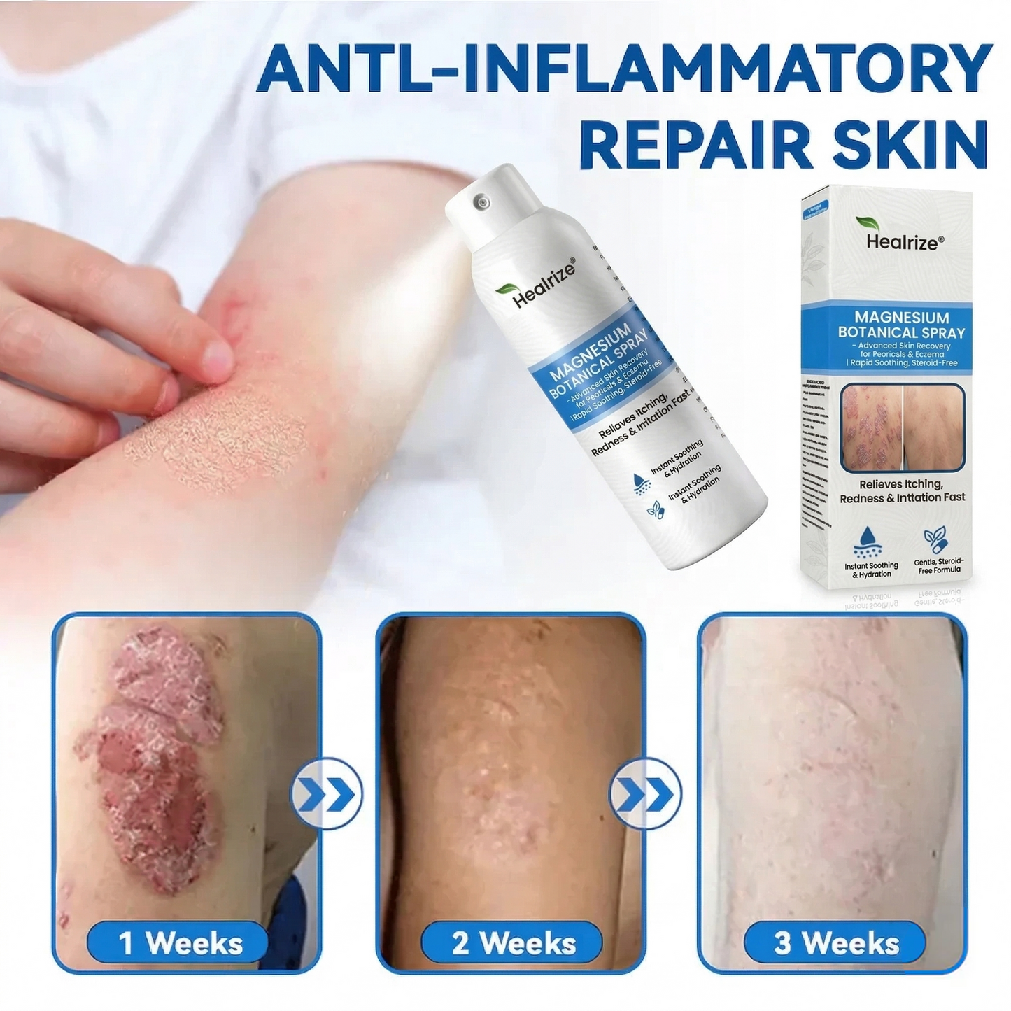 🌿Healrize® Magnesium Botanical Spray – Advanced Skin Recovery for Psoriasis & Eczema | Rapid Soothing, Steroid-Free
