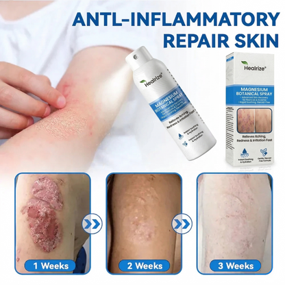 🌿Healrize® Magnesium Botanical Spray – Advanced Skin Recovery for Psoriasis & Eczema | Rapid Soothing, Steroid-Free