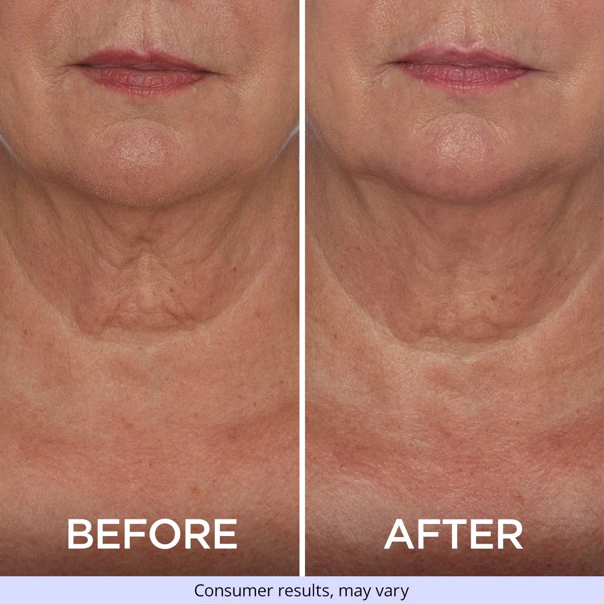Tighten & Lift Neck Cream