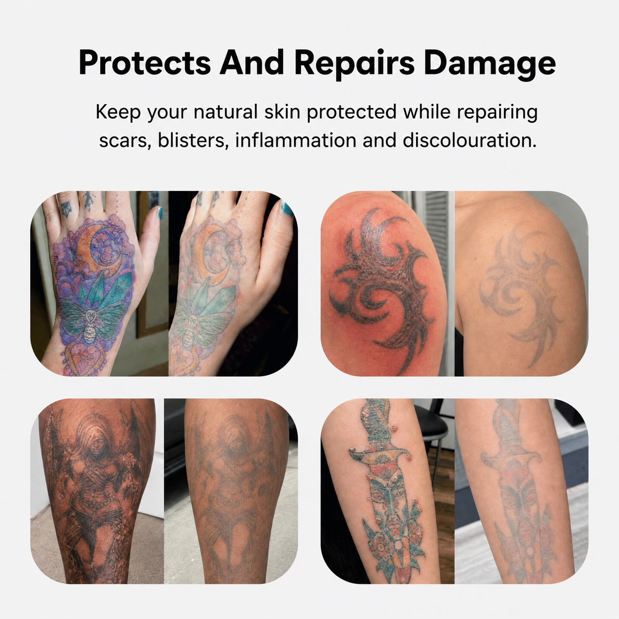 Natural Restoration Laser Aftercare Serum – Improves Skin Healing & Recovery Comfort